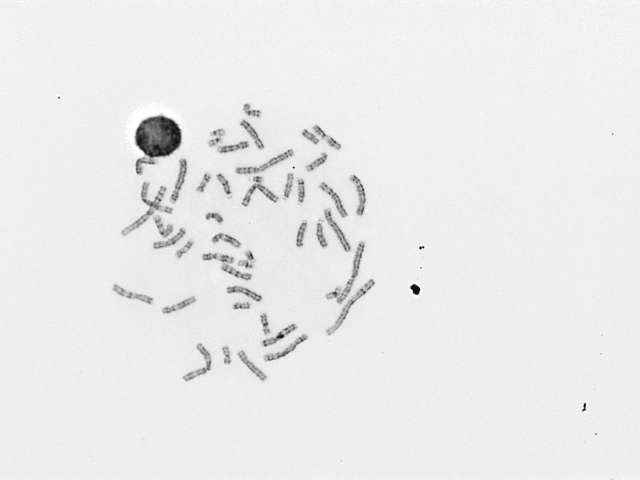 Chromosome Image